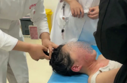 14歲，面、頸、胸燙傷，只因中午那鍋面湯…